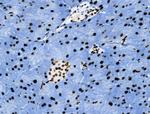 Phospho-Androgen Receptor (Tyr535) Polyclonal Antibody