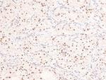 Phospho-53BP1 (Ser29) Antibody in Immunohistochemistry (Paraffin) (IHC (P))