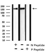 Phospho-53BP1 (Ser29) Antibody in Western Blot (WB)