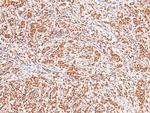 Phospho-Acinus (Ser1180) Antibody in Immunohistochemistry (Paraffin) (IHC (P))