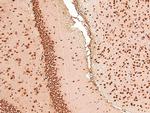 Phospho-Acinus (Ser1180) Antibody in Immunohistochemistry (Paraffin) (IHC (P))