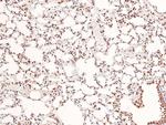 Phospho-Acinus (Ser1180) Antibody in Immunohistochemistry (Paraffin) (IHC (P))
