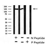 Phospho-Acinus (Ser1180) Antibody in Western Blot (WB)