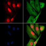 Phospho-AMPK beta-1 (Ser108) Antibody in Immunocytochemistry (ICC/IF)