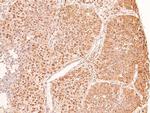 Phospho-AMPK beta-1 (Ser108) Antibody in Immunohistochemistry (Paraffin) (IHC (P))