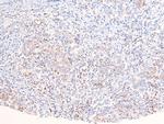 Phospho-ANKRD28 (Ser1007) Polyclonal Antibody