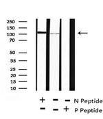 Phospho-ANKRD28 (Ser1007) Antibody in Western Blot (WB)
