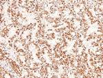 Phospho-BCLAF1 (Ser531) Antibody in Immunohistochemistry (Paraffin) (IHC (P))