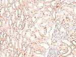 Phospho-BIK (Ser35) Antibody in Immunohistochemistry (Paraffin) (IHC (P))