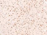 Phospho-Bim (Ser44, Ser104) Antibody in Immunohistochemistry (Paraffin) (IHC (P))