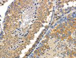 Phospho-Caldesmon (Ser759) Antibody in Immunohistochemistry (Paraffin) (IHC (P))