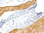 Phospho-Caldesmon (Ser759) Antibody in Immunohistochemistry (Paraffin) (IHC (P))