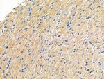 Phospho-Calpain 2 (Ser50) Antibody in Immunohistochemistry (Paraffin) (IHC (P))