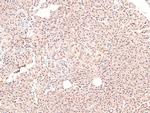 Phospho-ARHGAP31 (Thr789) Antibody in Immunohistochemistry (Paraffin) (IHC (P))