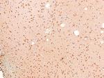 Phospho-ARHGAP31 (Thr789) Antibody in Immunohistochemistry (Paraffin) (IHC (P))