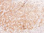 Phospho-ARHGAP31 (Thr789) Antibody in Immunohistochemistry (Paraffin) (IHC (P))