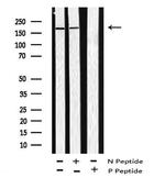 Phospho-ARHGAP31 (Thr789) Antibody in Western Blot (WB)