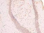 Phospho-Claspin (Ser30) Antibody in Immunohistochemistry (Paraffin) (IHC (P))