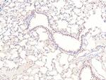 Phospho-Claspin (Ser30) Antibody in Immunohistochemistry (Paraffin) (IHC (P))