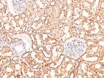Phospho-Claudin 1 (Tyr210) Antibody in Immunohistochemistry (Paraffin) (IHC (P))