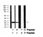Phospho-Claudin 4 (Tyr208) Antibody in Western Blot (WB)