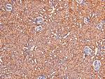Phospho-CtBP1/CtBP2 (Ser158, Ser164) Polyclonal Antibody