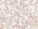 Phospho-CUX1 (Ser1237) Polyclonal Antibody