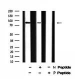 Phospho-EEF2K (Ser359) Polyclonal Antibody
