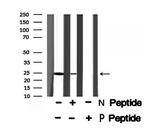 Phospho-RGS19 (Ser151) Antibody in Western Blot (WB)