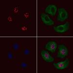 Phospho-JDP2 (Thr148) Antibody in Immunocytochemistry (ICC/IF)