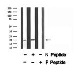 Phospho-JDP2 (Thr148) Antibody in Western Blot (WB)