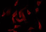 Phospho-LIMK1 (Ser310) Antibody in Immunocytochemistry (ICC/IF)