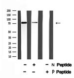 Phospho-LIMK1 (Ser310) Antibody in Western Blot (WB)