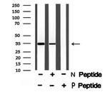 Phospho-MCL-1 (Thr163) Polyclonal Antibody