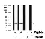 Phospho-NACA (Thr159) Antibody in Western Blot (WB)