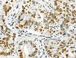 Phospho-NFATC1 (Ser172) Antibody in Immunohistochemistry (Paraffin) (IHC (P))