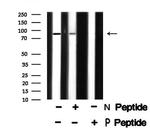 Phospho-PDE4D (Ser715) Antibody in Western Blot (WB)