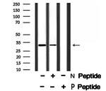 Phospho-PDX1 (Ser66) Antibody in Western Blot (WB)