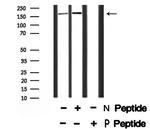 Phospho-TRAP220 (Thr1032) Polyclonal Antibody