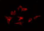 Phospho-Progesterone Receptor (Ser345) Antibody in Immunocytochemistry (ICC/IF)