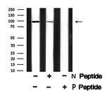 Phospho-Progesterone Receptor (Ser345) Antibody in Western Blot (WB)