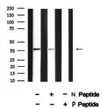 Phospho-RAD51 (Thr309) Polyclonal Antibody