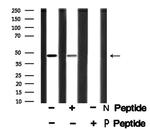 Phospho-SPHK1 (Ser225) Polyclonal Antibody