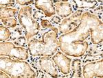 Phospho-SREBP2 (Ser455) Polyclonal Antibody
