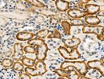 Phospho-SREBP2 (Ser455) Antibody in Immunohistochemistry (Paraffin) (IHC (P))