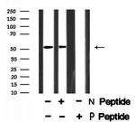 Phospho-NR5A1 (Ser203) Polyclonal Antibody