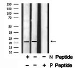 Phospho-STMN2 (Ser73) Antibody in Western Blot (WB)