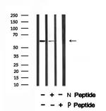 Phospho-TAB1 (Ser438) Antibody in Western Blot (WB)