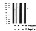 Phospho-Torc2 (Ser171) Antibody in Western Blot (WB)