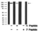 Phospho-53BP1 (Ser1778) Antibody in Western Blot (WB)